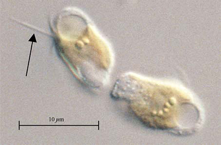 Zdjęcie mikroskopowe dwóch komórek Prymnesium parvum